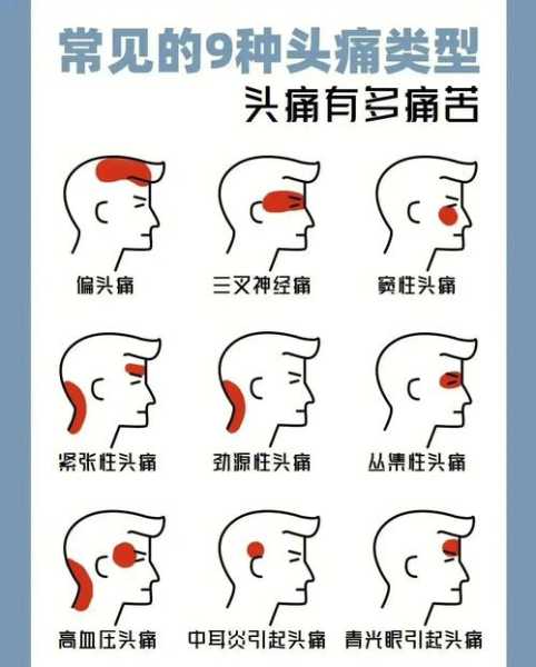 天气好头顶疼(到底怎么回事)