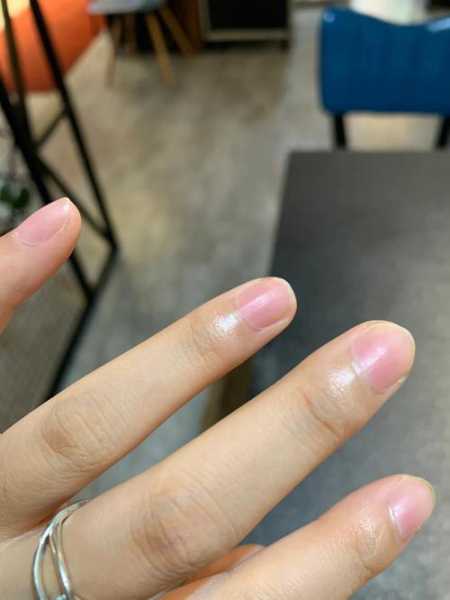 天气冷手变黑,是什么原因导致的?